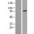 Western Blot: ABCD2 Lysate [NBL1-07180] - Western Blot experiments. 
Left-Control; Right -Over-expression Lysate for ABCD2